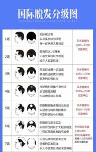 人工植发多少钱一根，人工植发技术成熟吗-第3张图片-山川游戏