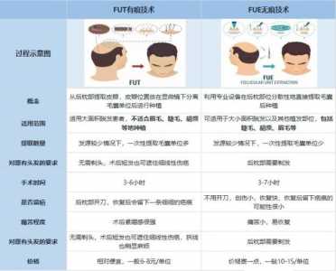 人工植发多少钱一根，人工植发技术成熟吗-第4张图片-山川游戏