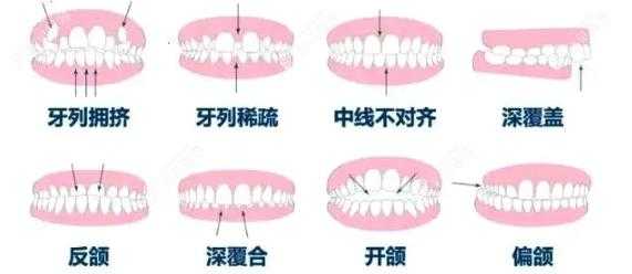 洛克王国提亚怎么获得，洛克王国提亚怎么获得技能-第3张图片-山川游戏